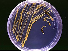 220px-Agar_plate_with_colonies